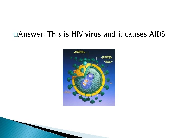 � Answer: This is HIV virus and it causes AIDS 