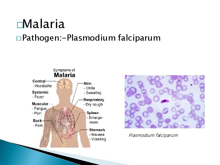 �Malaria � Pathogen: -Plasmodium falciparum 