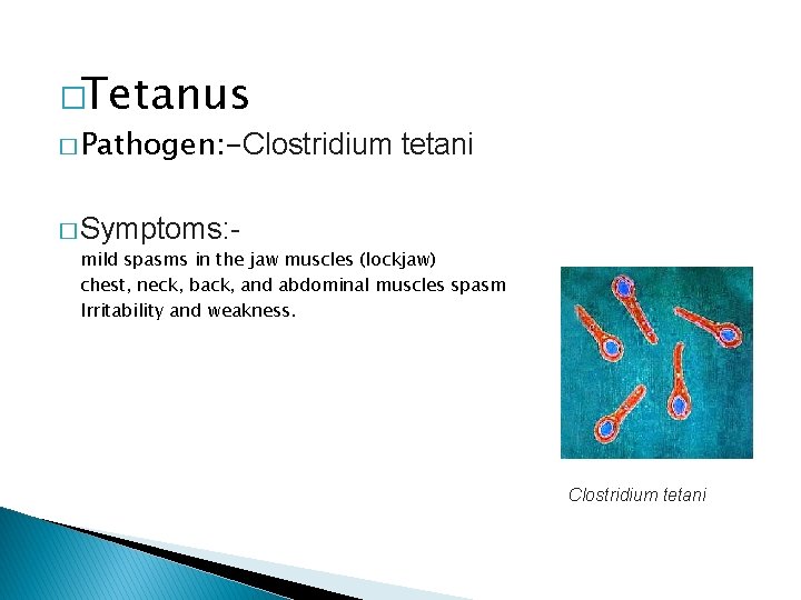 �Tetanus � Pathogen: -Clostridium tetani � Symptoms: mild spasms in the jaw muscles (lockjaw)