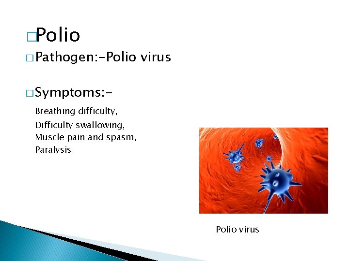 �Polio � Pathogen: -Polio virus � Symptoms: Breathing difficulty, Difficulty swallowing, Muscle pain and