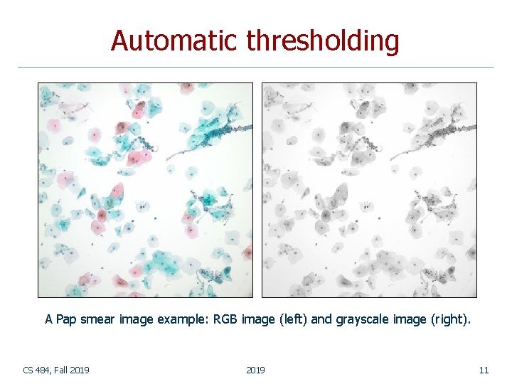 Automatic thresholding A Pap smear image example: RGB image (left) and grayscale image (right). Automatic thresholding A Pap smear image example: RGB image (left) and grayscale image (right).
