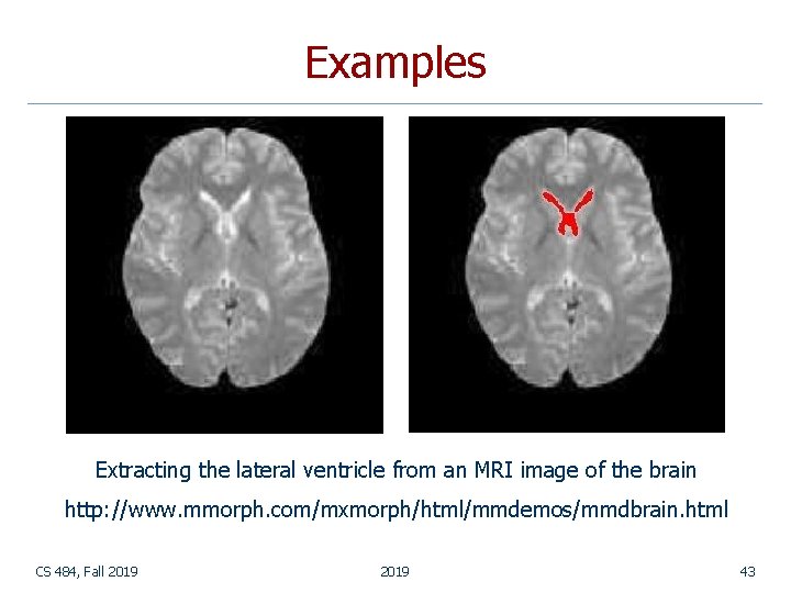 Examples Extracting the lateral ventricle from an MRI image of the brain http: //www. Examples Extracting the lateral ventricle from an MRI image of the brain http: //www.