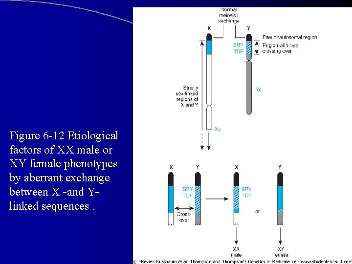 Figure 6 -12 Etiological factors of XX male or XY female phenotypes by aberrant