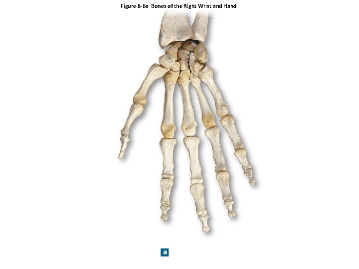 Figure 8 -6 a Bones of the Right Wrist and Hand 