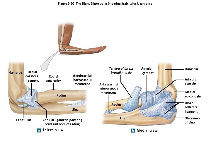 Figure 9 -10 The Right Elbow Joint Showing Stabilizing Ligaments Humerus Radial collateral ligament