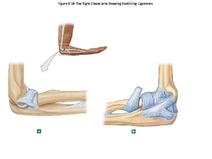 Figure 9 -10 The Right Elbow Joint Showing Stabilizing Ligaments 