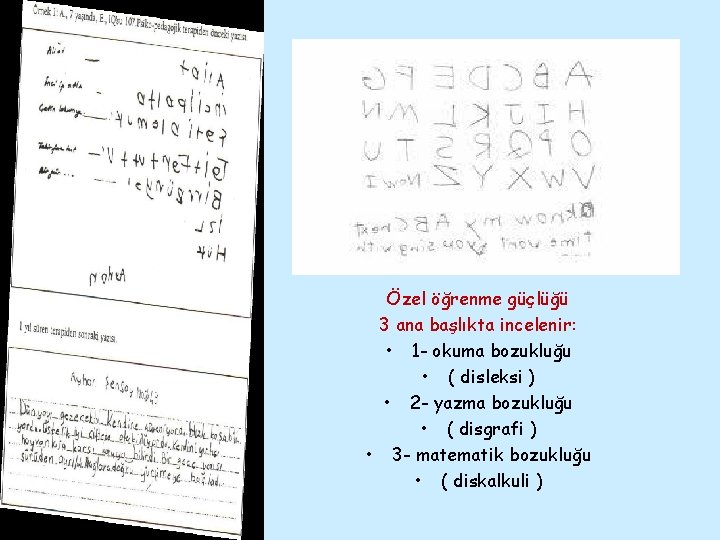 Özel öğrenme güçlüğü 3 ana başlıkta incelenir: • 1 - okuma bozukluğu • (