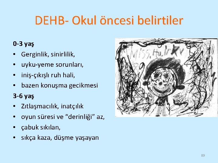 DEHB- Okul öncesi belirtiler 0 -3 yaş • Gerginlik, sinirlilik, • uyku-yeme sorunları, •