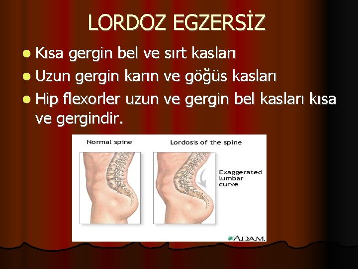 LORDOZ EGZERSİZ Kısa gergin bel ve sırt kasları Uzun gergin karın ve göğüs kasları