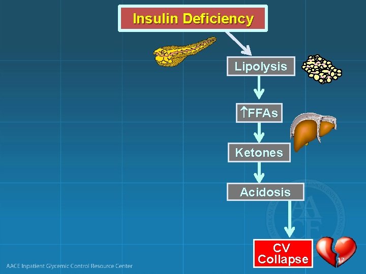 Insulin Deficiency Lipolysis FFAs Ketones Acidosis CV Collapse 17 