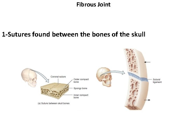 Fibrous Joint 1 -Sutures found between the bones of the skull 