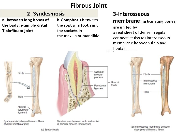 Fibrous Joint 2 - Syndesmosis a- between long bones of the body, example distal