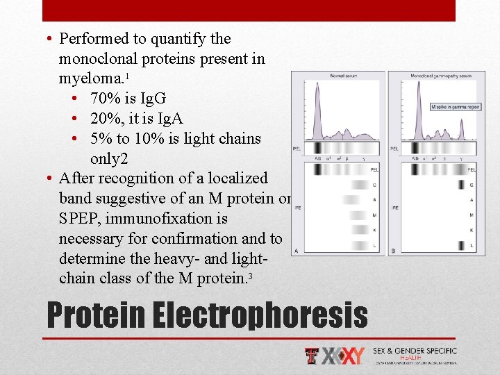  • Performed to quantify the monoclonal proteins present in myeloma. 1 • 70%