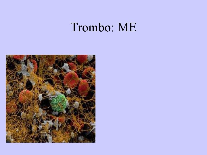Trombo: ME 