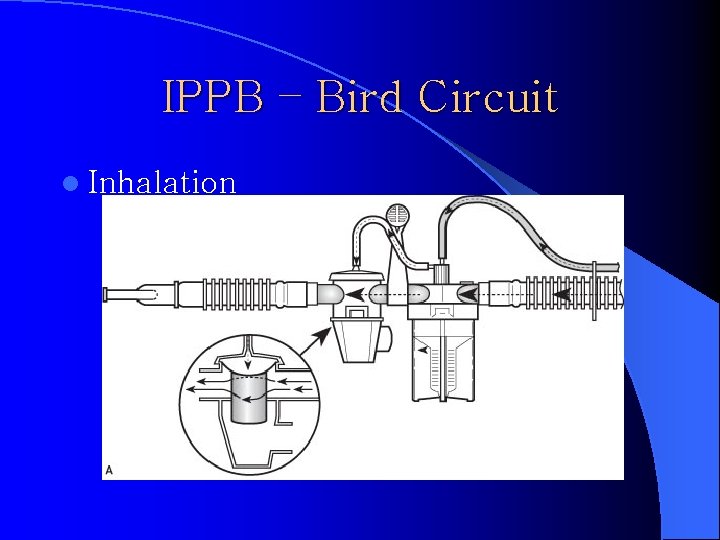IPPB – Bird Circuit l Inhalation 