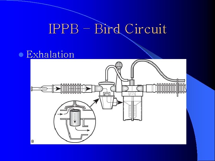 IPPB – Bird Circuit l Exhalation 