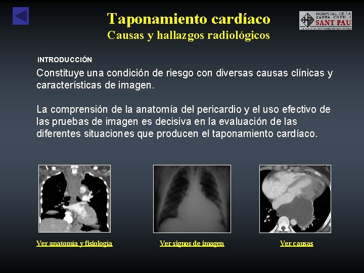 Taponamiento cardíaco Causas y hallazgos radiológicos INTRODUCCIÓN Constituye una condición de riesgo con diversas