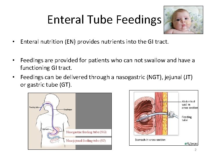 Enteral Tube Feedings • Enteral nutrition (EN) provides nutrients into the GI tract. •