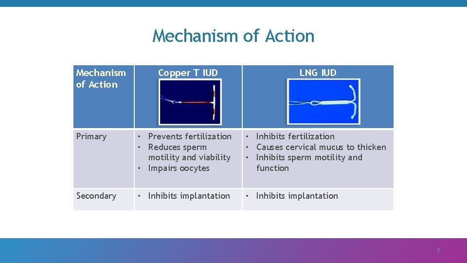 Mechanism of Action Copper T IUD LNG IUD Primary • Prevents fertilization • Reduces