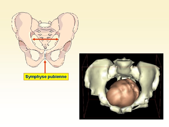 Symphyse pubienne 