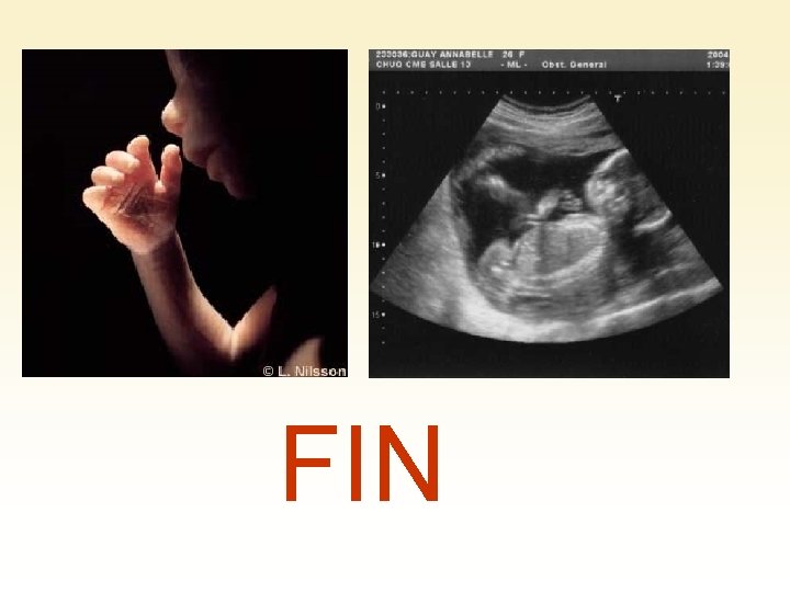 FIN 