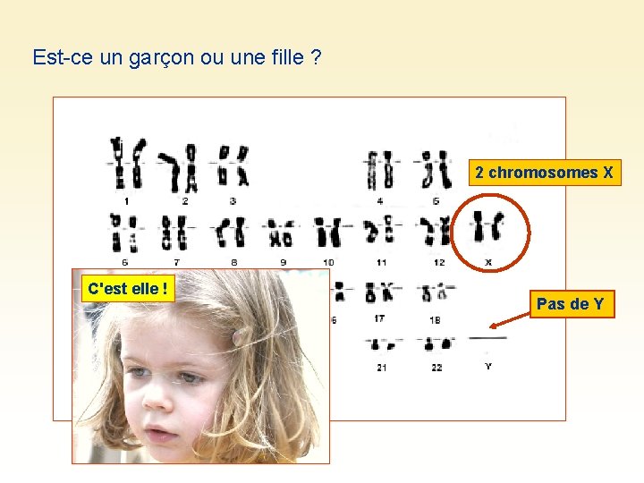 Est-ce un garçon ou une fille ? 2 chromosomes X C'est elle ! Pas