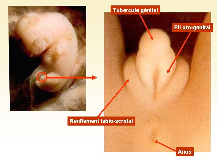 Tubercule génital Pli uro-génital Renflement labio-scrotal Anus 