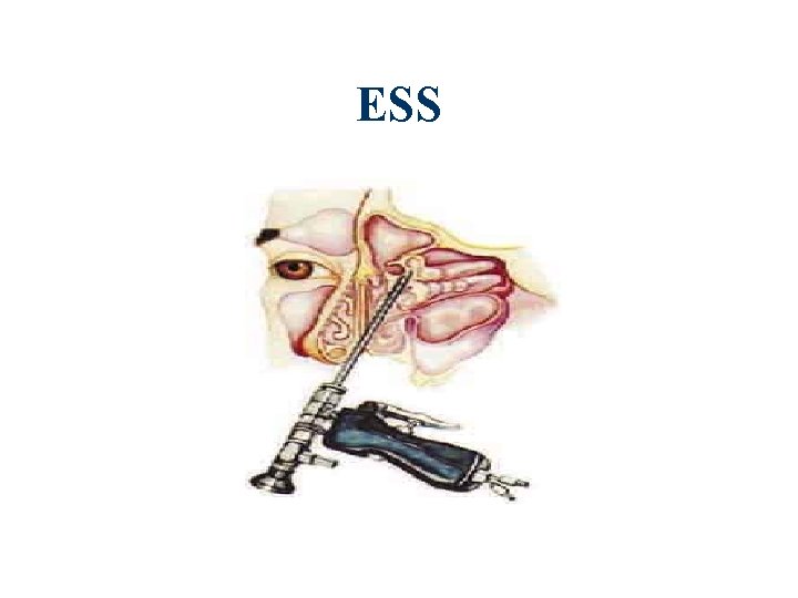 ESS 