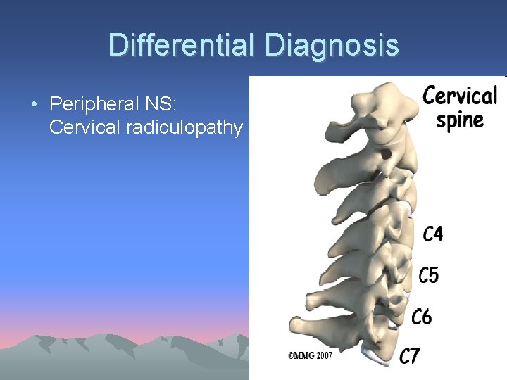Differential Diagnosis • Peripheral NS: Cervical radiculopathy 