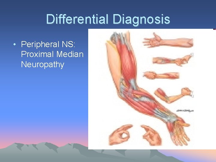 Differential Diagnosis • Peripheral NS: Proximal Median Neuropathy 