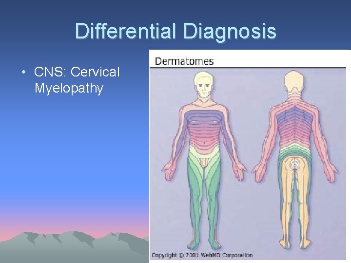 Differential Diagnosis • CNS: Cervical Myelopathy 