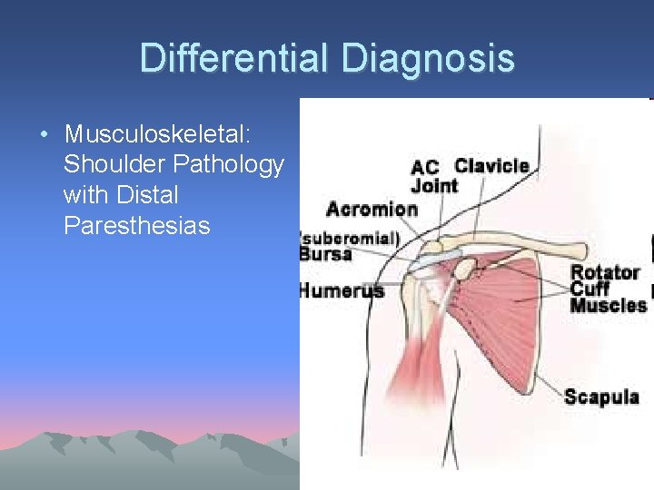 Differential Diagnosis • Musculoskeletal: Shoulder Pathology with Distal Paresthesias 