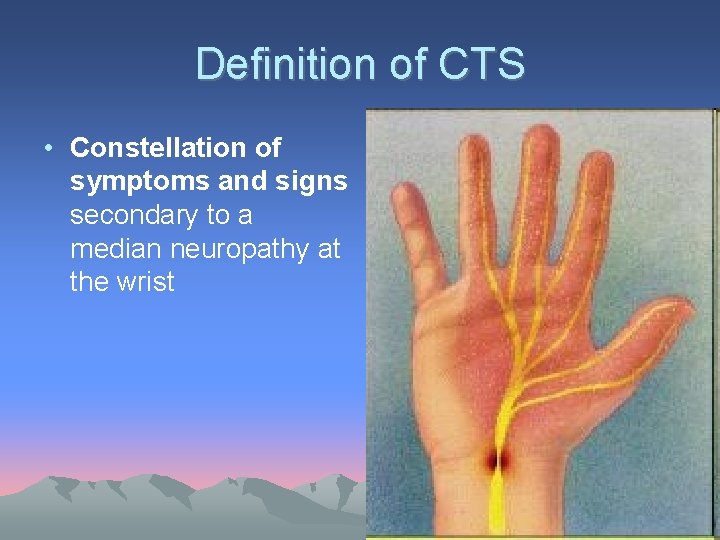 Definition of CTS • Constellation of symptoms and signs secondary to a median neuropathy