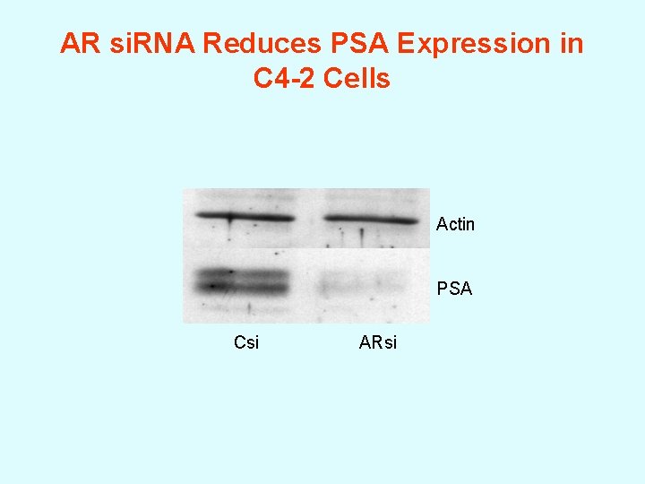 AR si. RNA Reduces PSA Expression in C 4 -2 Cells Actin PSA Csi