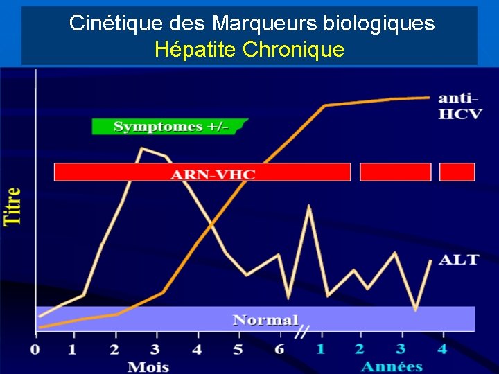 Cinétique des Marqueurs biologiques Hépatite Chronique Marqueurs réplication ARN-VHC Ag VHC Ac anti-VHC ALAT