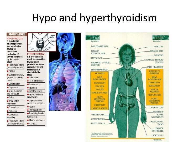 Hypo and hyperthyroidism 