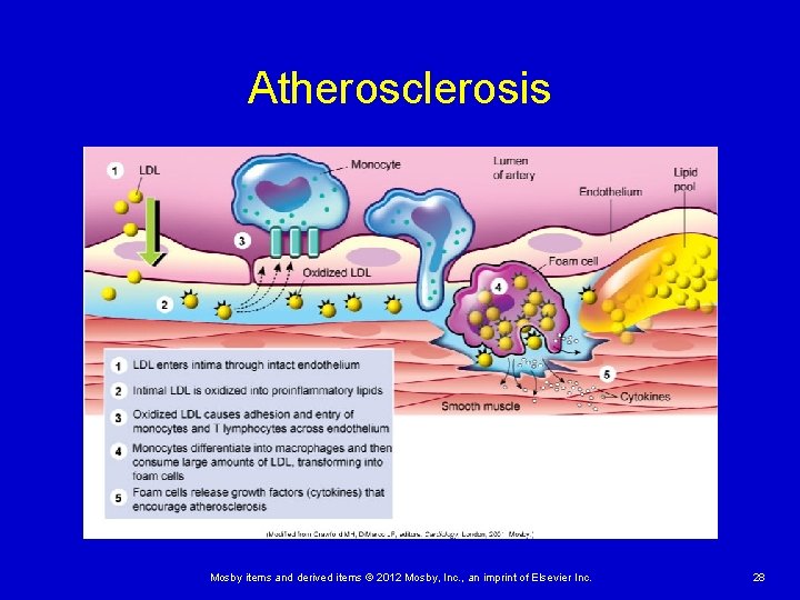 Atherosclerosis Mosby items and derived items © 2012 Mosby, Inc. , an imprint of