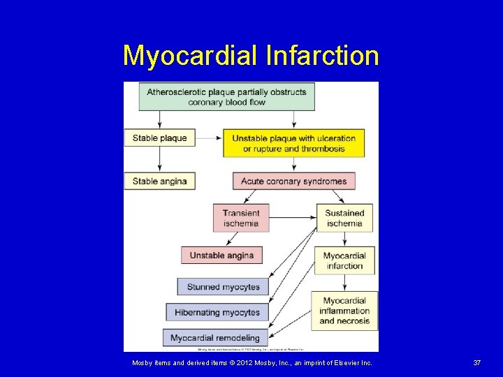 Myocardial Infarction Mosby items and derived items © 2012 Mosby, Inc. , an imprint