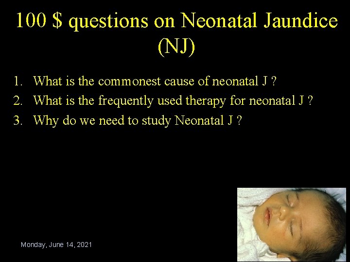 100 $ questions on Neonatal Jaundice (NJ) 1. What is the commonest cause of