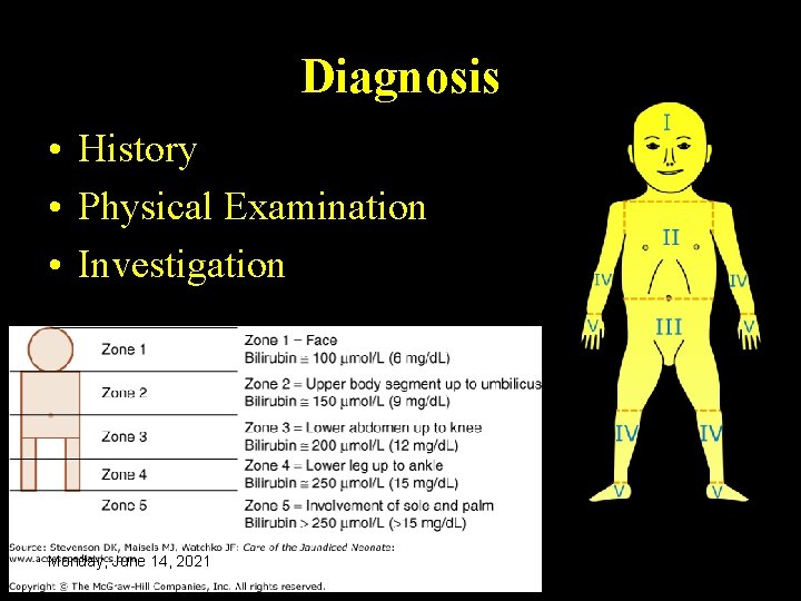 Diagnosis • History • Physical Examination • Investigation Monday, June 14, 2021 36 