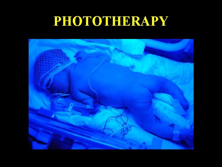 PHOTOTHERAPY Monday, June 14, 2021 47 