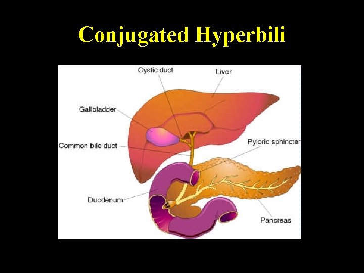 Conjugated Hyperbili Monday, June 14, 2021 56 