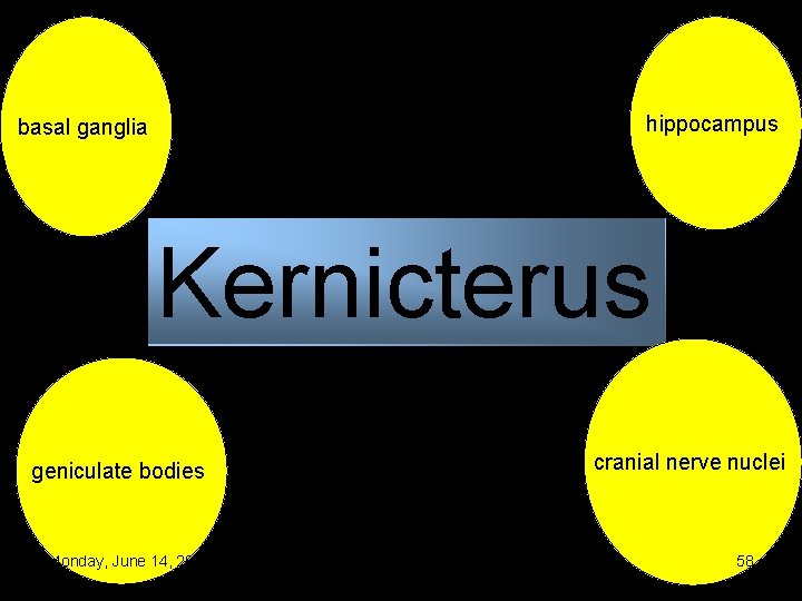 hippocampus basal ganglia Kernicterus geniculate bodies Monday, June 14, 2021 cranial nerve nuclei 58