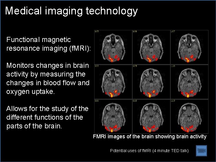 Medical imaging technology Functional magnetic resonance imaging (f. MRI): Monitors changes in brain activity