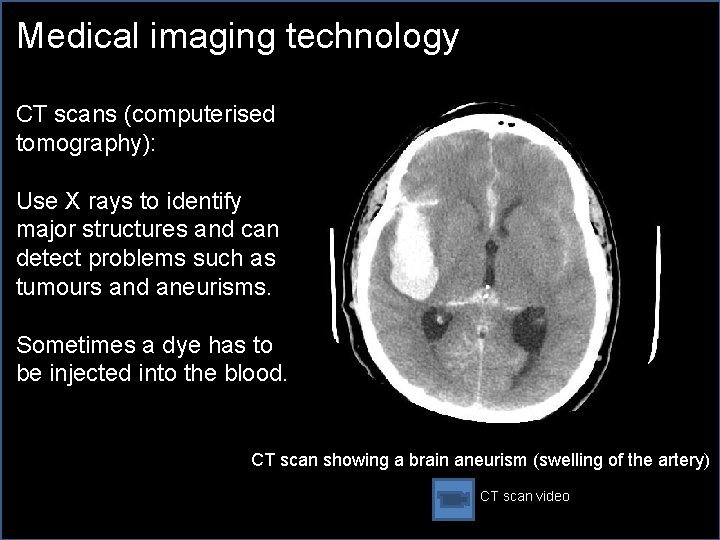 Medical imaging technology CT scans (computerised tomography): Use X rays to identify major structures