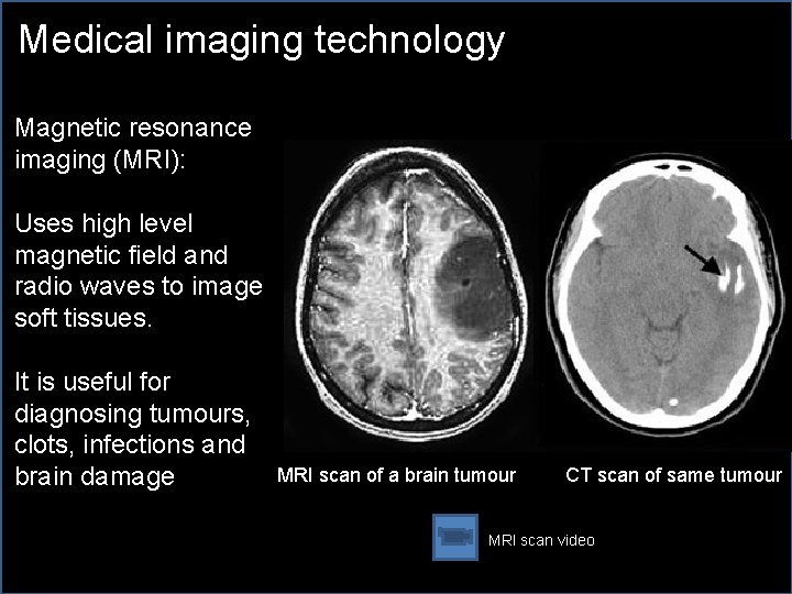Medical imaging technology Magnetic resonance imaging (MRI): Uses high level magnetic field and radio