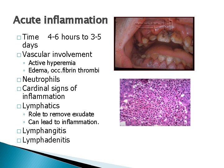 Acute inflammation � Time 4 -6 hours to 3 -5 days � Vascular involvement