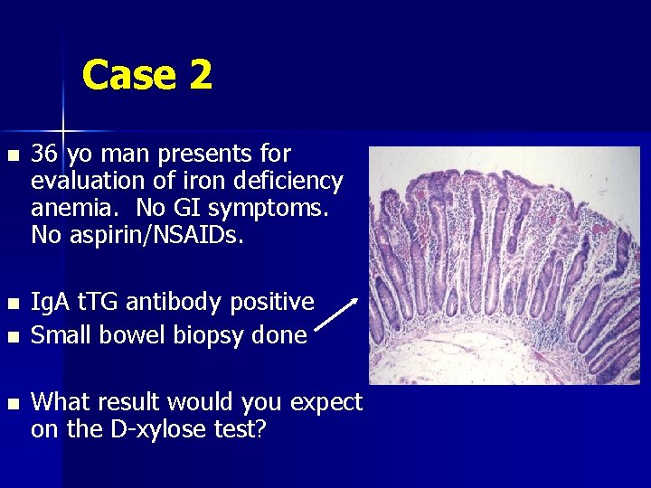 Case 2 n n 36 yo man presents for evaluation of iron deficiency anemia.