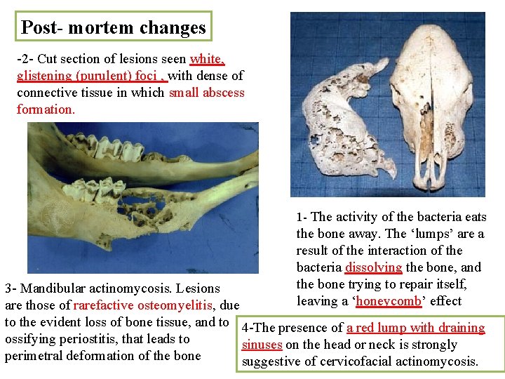 Post- mortem changes -2 - Cut section of lesions seen white, glistening (purulent) foci