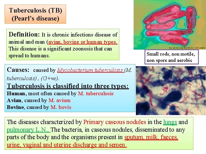 Tuberculosis (TB) (Pearl’s disease) Definition: It is chronic infections disease of animal and man
